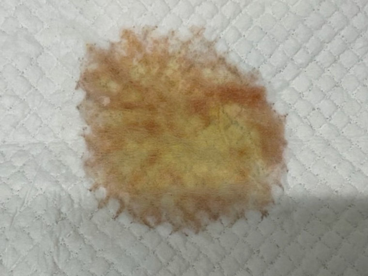膀胱癌のワンちゃんで認められた血尿:薄く血が混じるもの