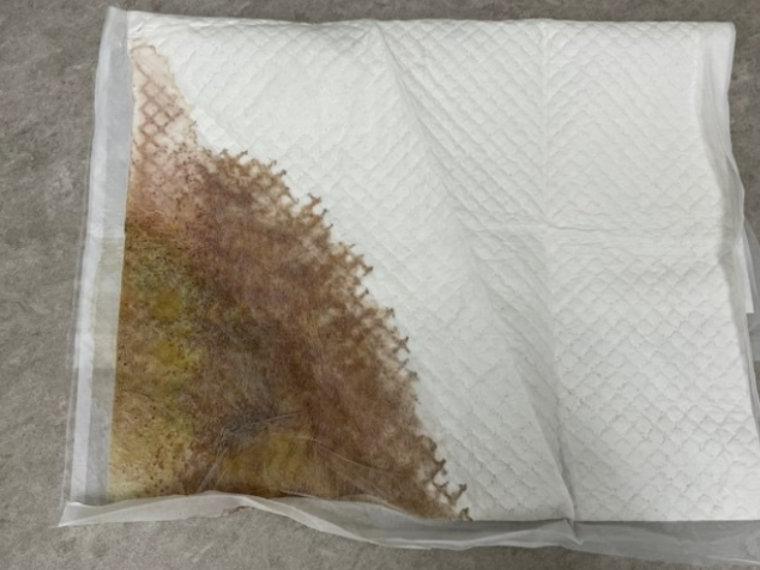 膀胱癌のワンちゃんで認められた血尿:茶褐色の尿