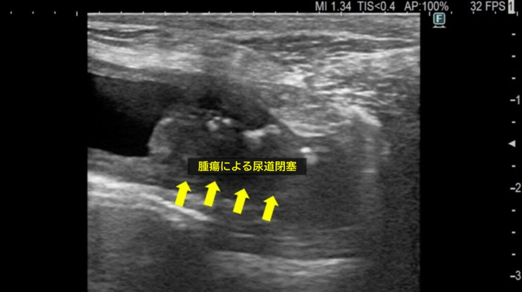 膀胱腫瘍によって尿道閉塞を起こした症例の超音波検査画像