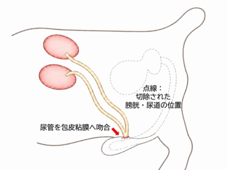 雄犬の膀胱全摘・尿路再建術の一例