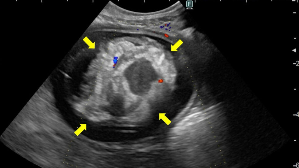 膀胱の超音波検査画像：膀胱の中を大きく占める腫瘍が確認されます